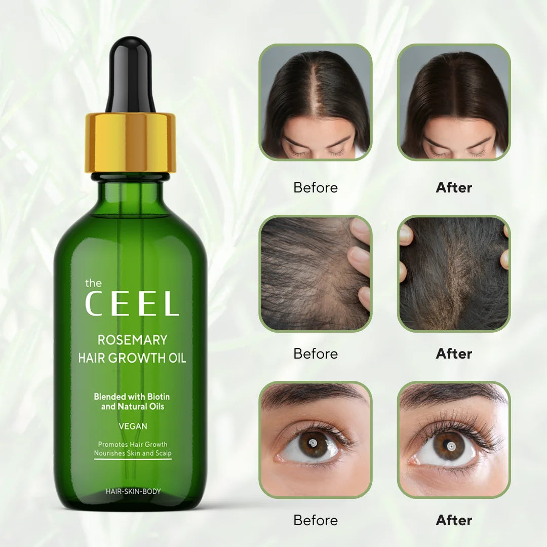 Rosemary Oil with Dermaroller - Strong Formula with Biotin & Natural Oil (Skin & Hair Care) 50ml