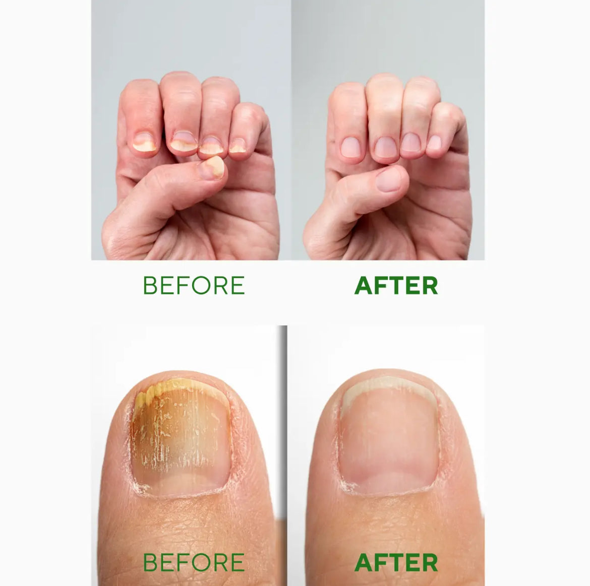 Nail Repair Serum - 30 ml